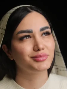 فیلر لب و گونه