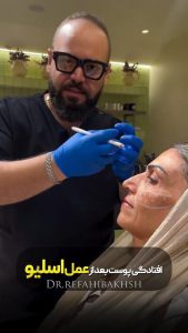 نکته مهم در مورد عمل اسلیو